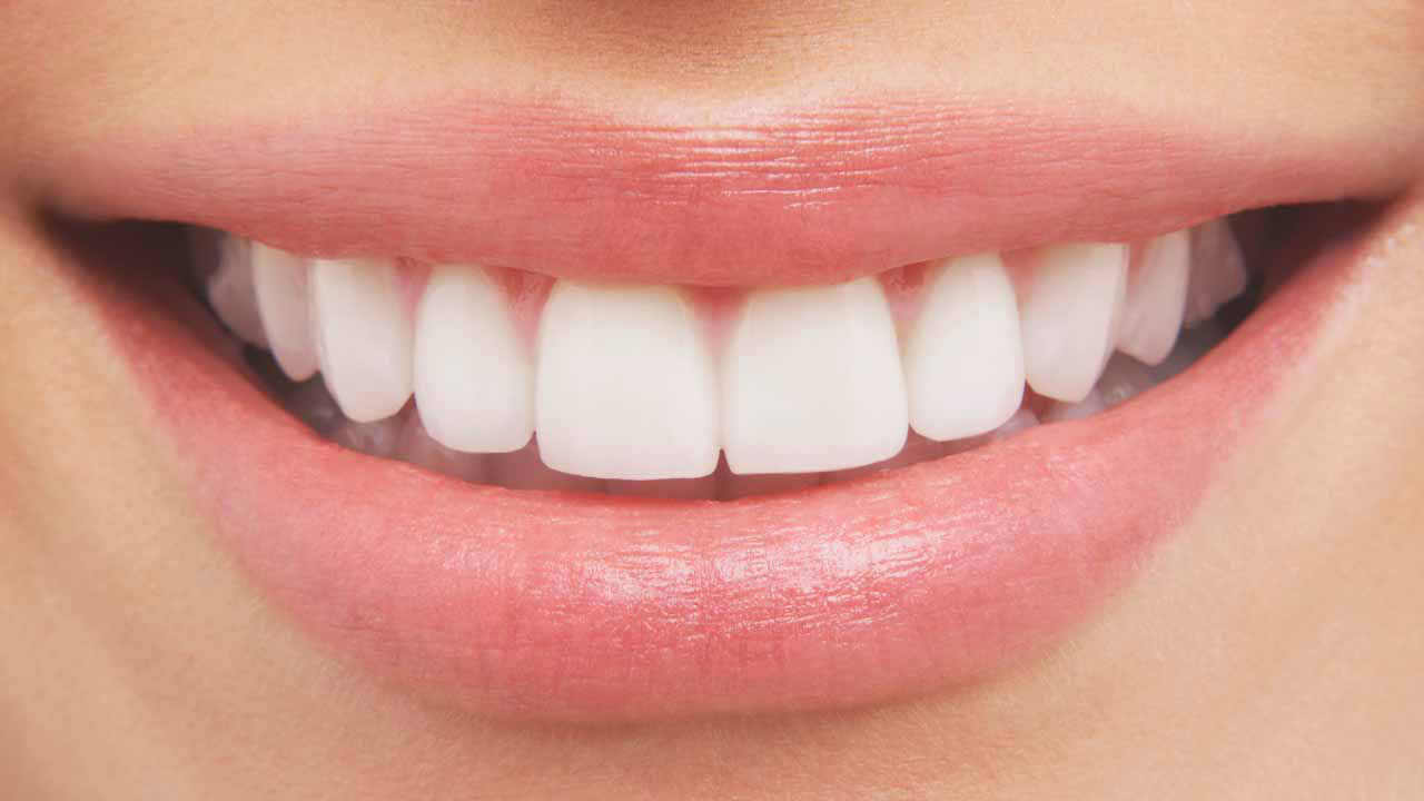 Dentist on the Upper East Side