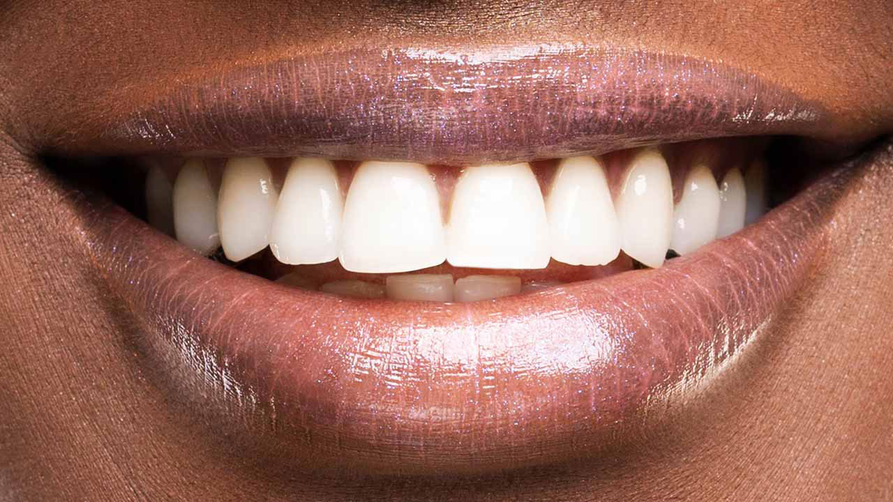 Dentist on the Upper East Side