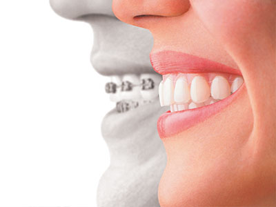 Divine Smiles Dental | Preventative Program, Dental Cleanings and Snoring Appliances