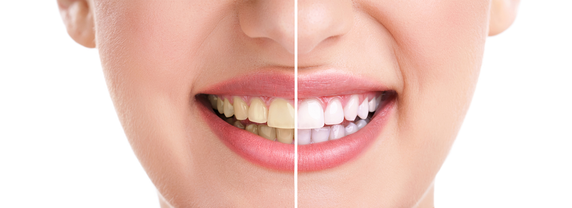 Divine Smiles Dental | Sports Mouthguards, Dental Cleanings and All-on-X